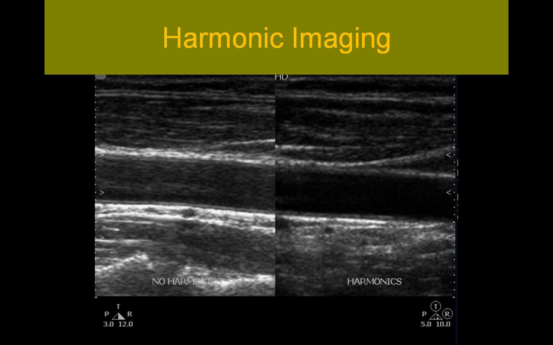 Slide Show Image 4